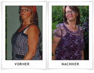 Die Abmagerung ohne Eiweiß